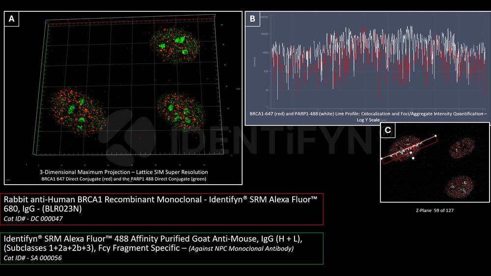 Super Resolution - SIM | Rabbit anti-Human BRCA1 Recombinant Monoclonal ...