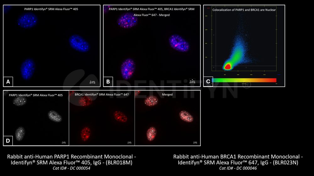 Widefield | Rabbit anti-Human PARP1 Recombinant Monoclonal - Identifyn ...