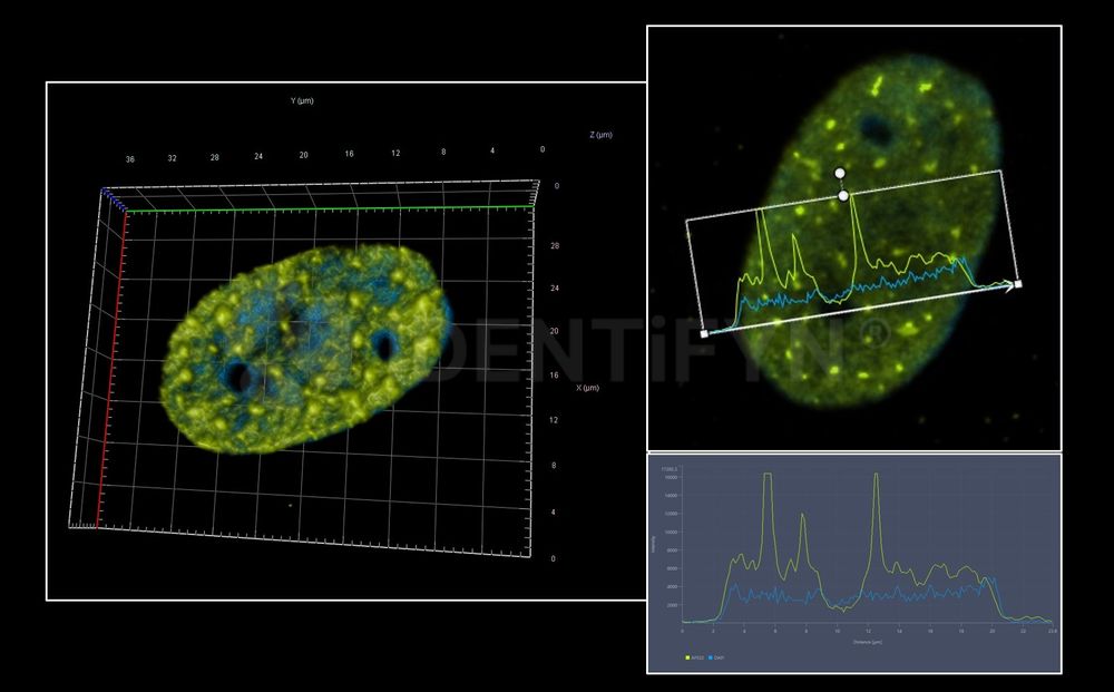 Widefield SIM | Rabbit anti-Human γH2Ax Recombinant Monoclonal ...