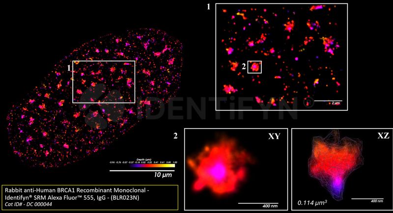 Super Resolution - Single Molecule STORM | Rabbit anti-Human BRCA1 ...